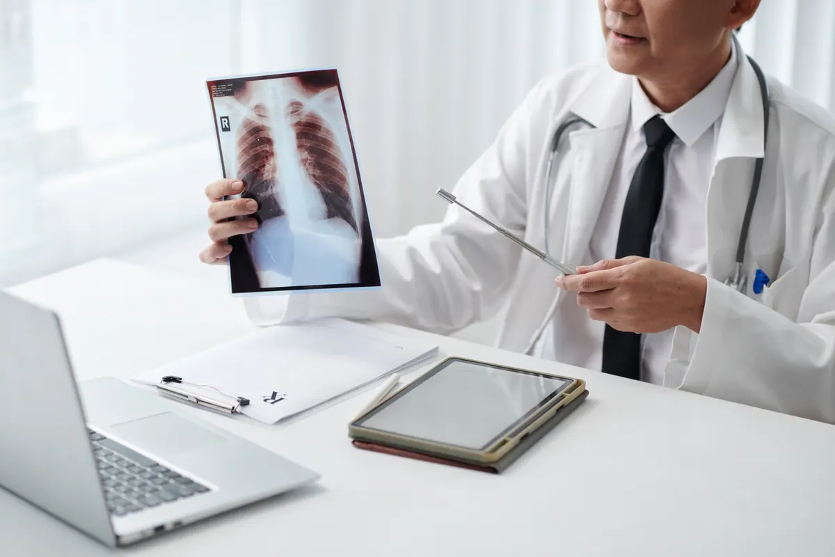 Chest and Lung Surgery with Sanitas
