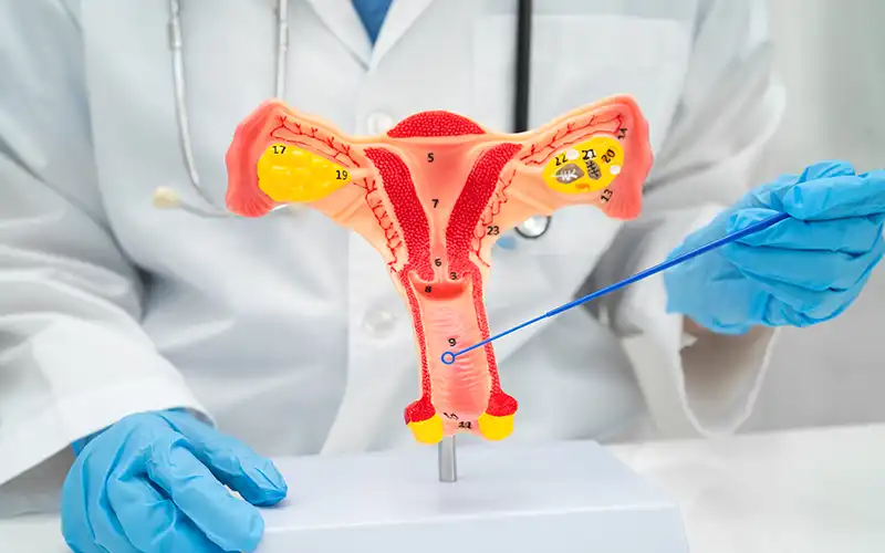 Doctor describing endometriosis points