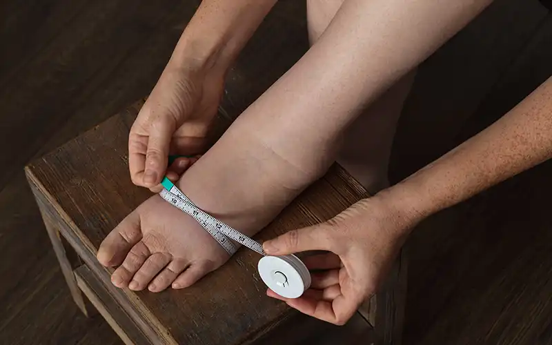 Managing swollen foot with lymphedema condition