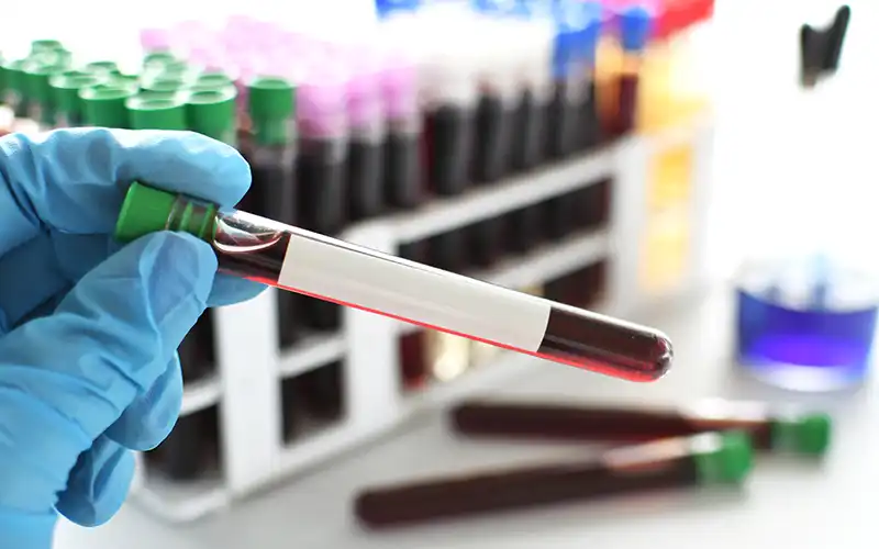 vial of blood for testing