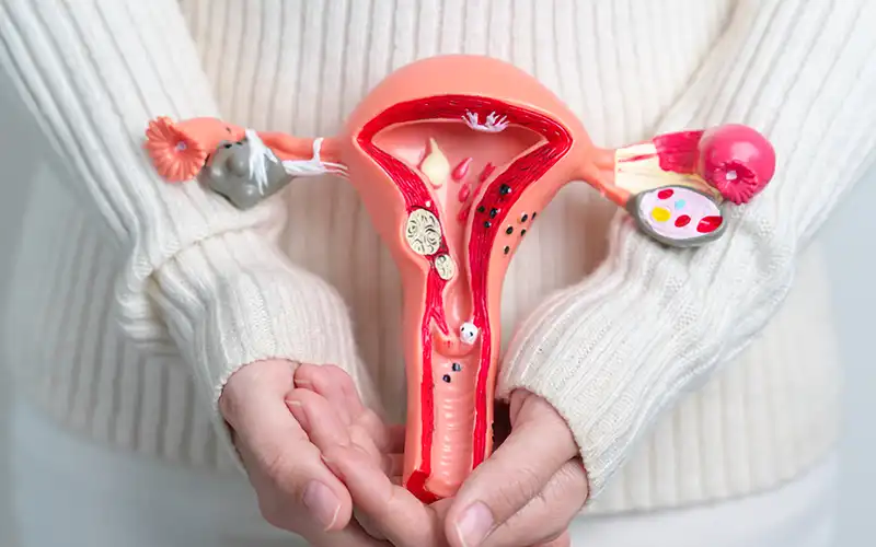 Model uterus indicating polyps